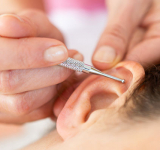 Réflexologie auriculaire : des points de pression dans l’oreille